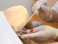 Mani guantate raccolgono un tampone vaginale per un esame, forse per verificare la gravidanza o altre condizioni.