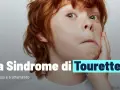 Primo piano di un bambino con capelli rossi, che mostra alcuni sintomi della sindrome di Tourette. Testo: "La Sindrome di Tourette. Diagnosi e trattamento.