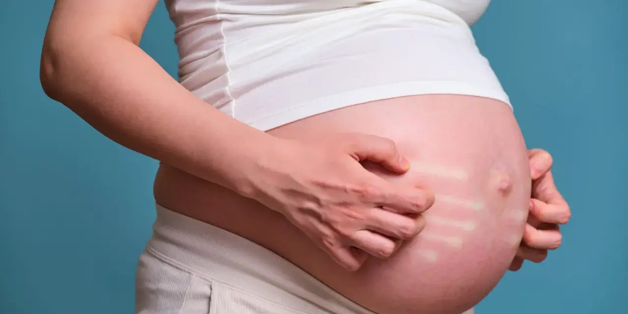 Pancia di donna incinta che si gratta, mostrando segni di prurito in gravidanza.