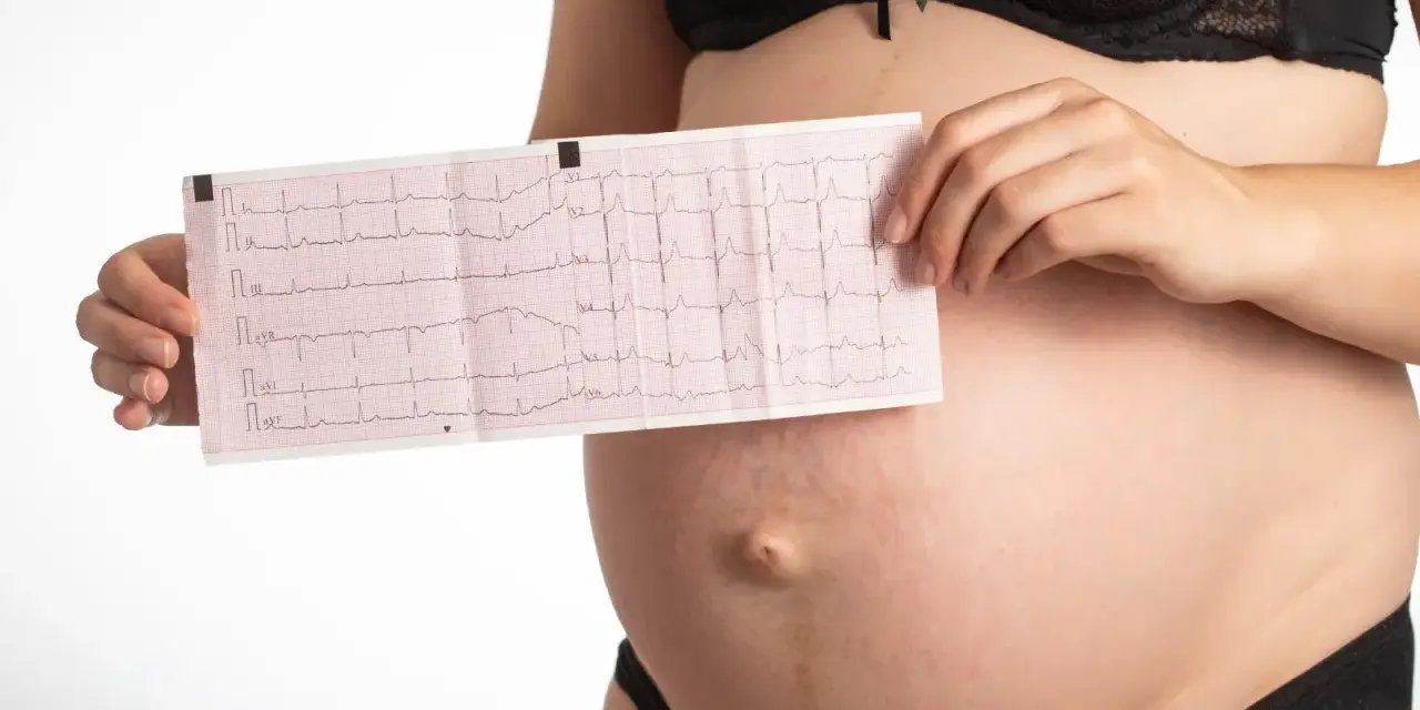 Donna incinta mostra un elettrocardiogramma, preoccupata per la tachicardia in gravidanza.