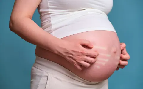 Pancia di donna incinta che si gratta, mostrando segni di prurito in gravidanza.