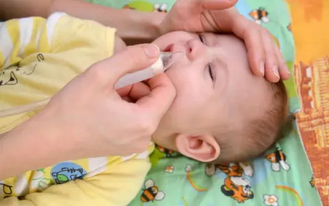 Mani che aiutano un neonato a liberare il naso dal muco, evitando il soffocamento.