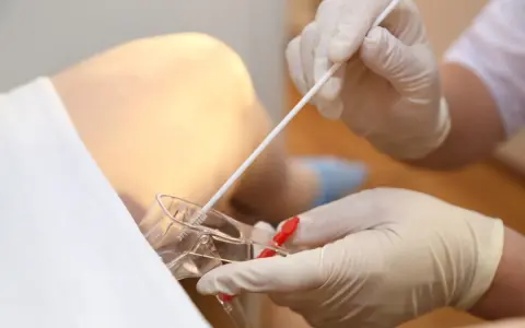 Mani guantate raccolgono un tampone vaginale per un esame, forse per verificare la gravidanza o altre condizioni.