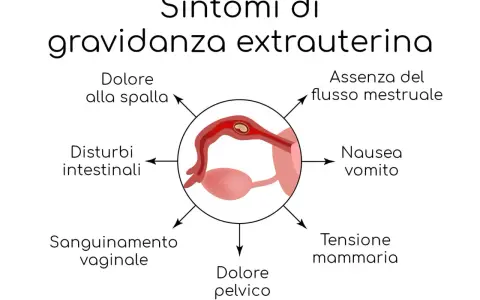 Sintomi di gravidanza extrauterina: dolore spalla, assenza flusso mestruale, nausea, tensione mammaria, dolore pelvico, sanguinamento, disturbi intestinali.