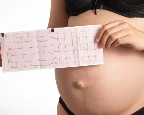 Donna incinta mostra un elettrocardiogramma, preoccupata per la tachicardia in gravidanza.