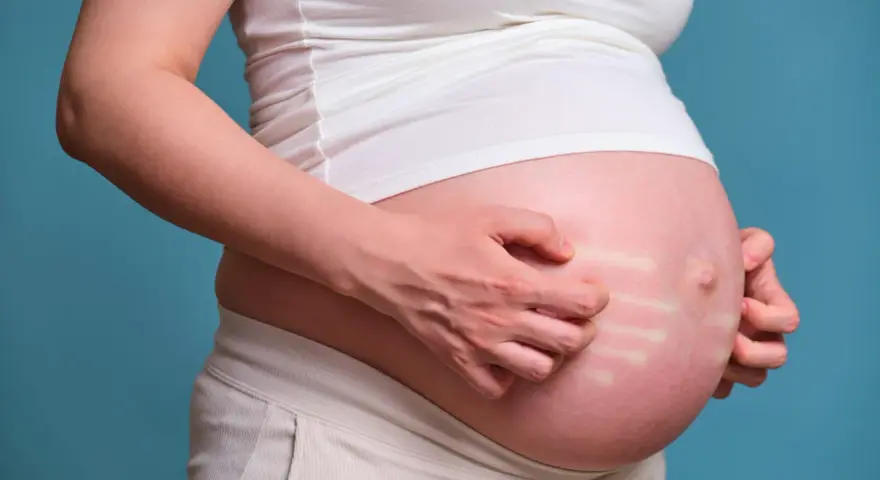 Pancia di donna incinta che si gratta, mostrando segni di prurito in gravidanza.