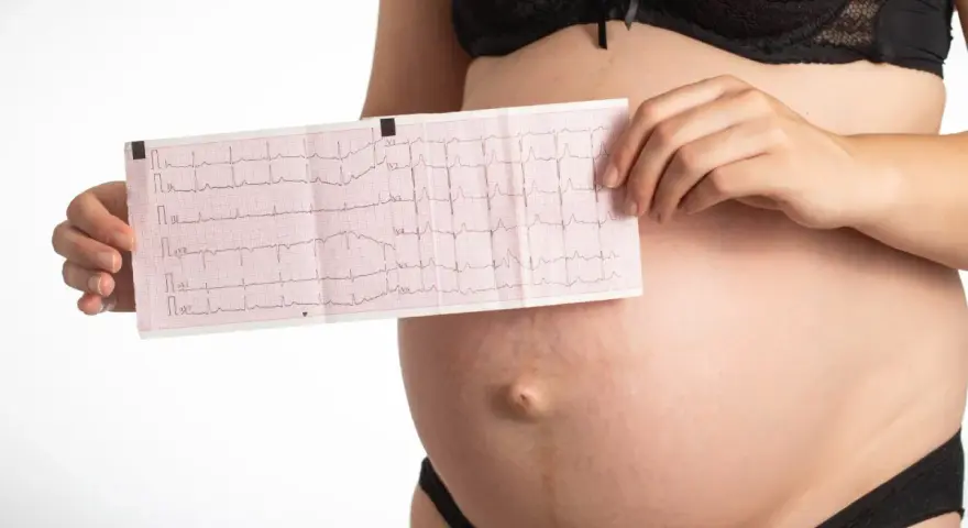 Donna incinta mostra un elettrocardiogramma, preoccupata per la tachicardia in gravidanza.