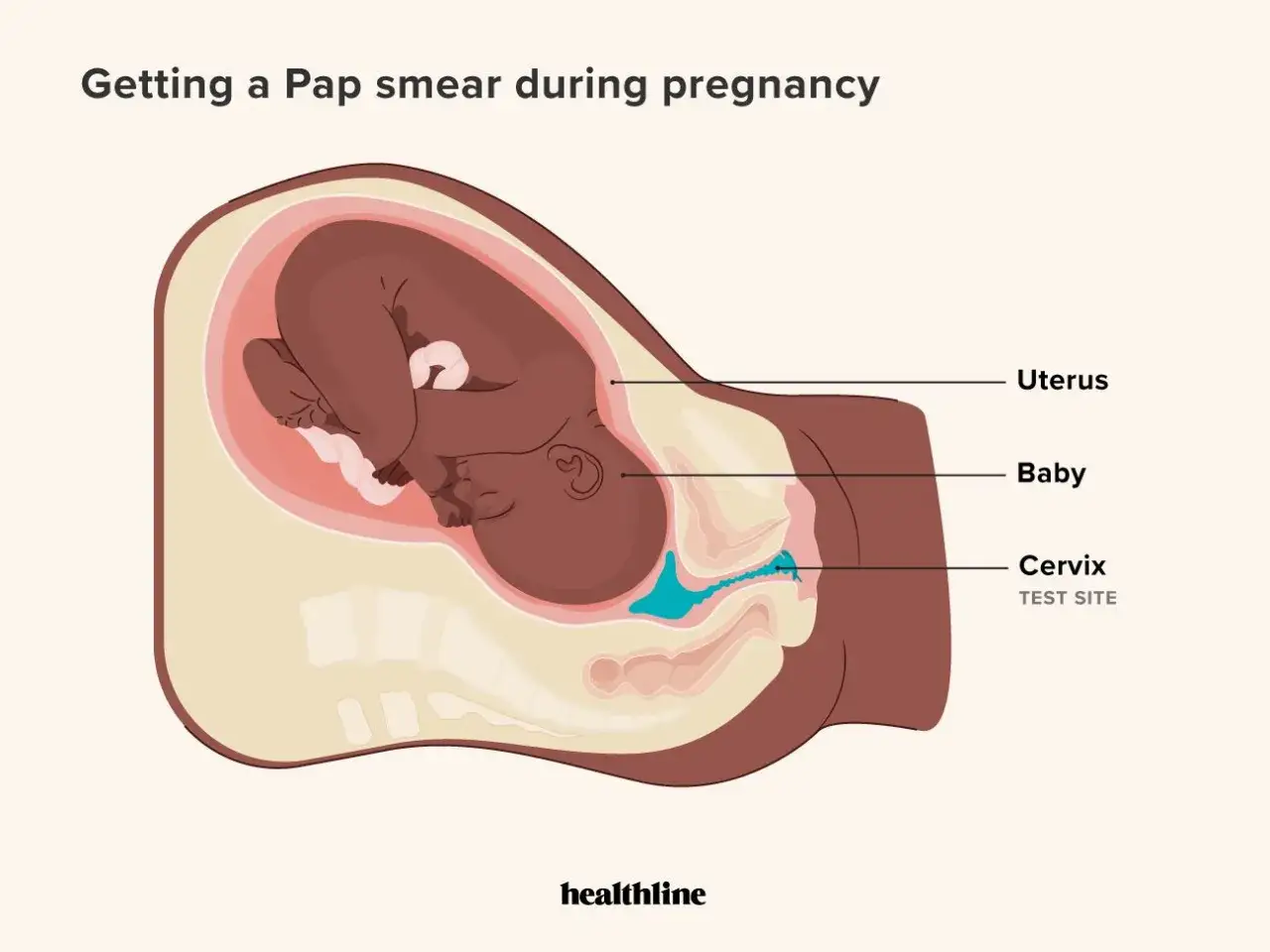 Illustrazione anatomica mostra un feto nell'utero, con il sito del pap test evidenziato sulla cervice.